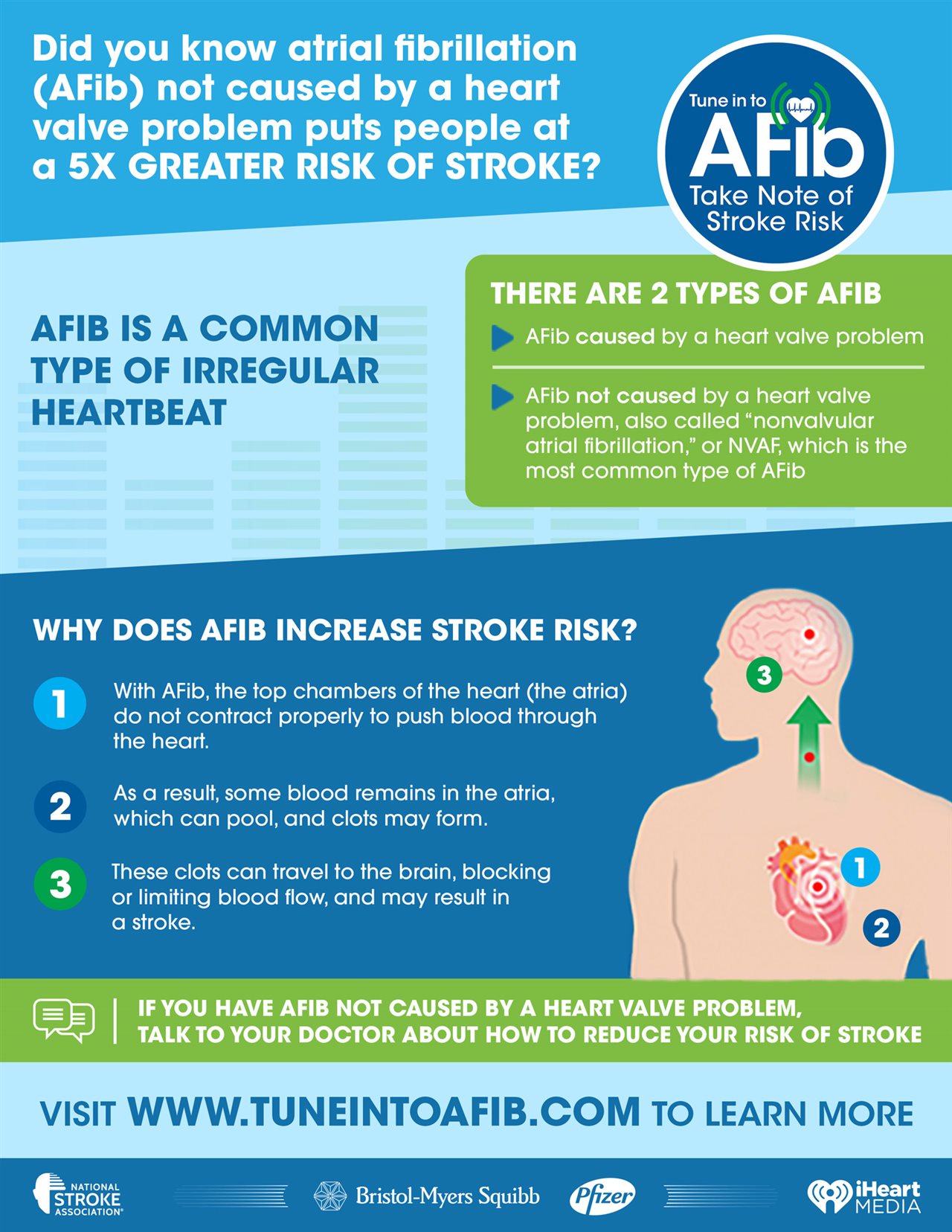 Anticoagulants:  The Key To Preventing Another Afib Stroke? - 7ldsx6c