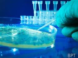 Bacteria lurking in your home plumbing