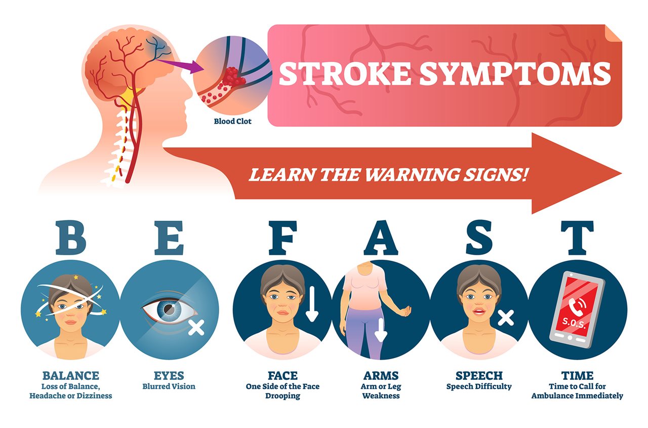 Infographic about Stroke symptoms and talks about the warning signes associated with the acronym 